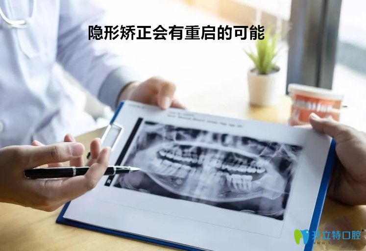 隱形矯正如果操作不當可能導致重啟