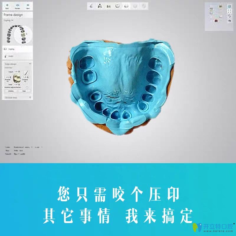 博世達隱形牙套具備其他品牌隱形牙套所不具備的優(yōu)勢