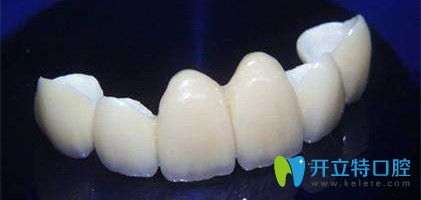 德國澤康全瓷牙