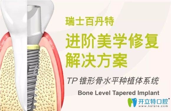 認(rèn)真看完這篇介紹,你對(duì)瑞士百丹特種植體就不覺(jué)得陌生了