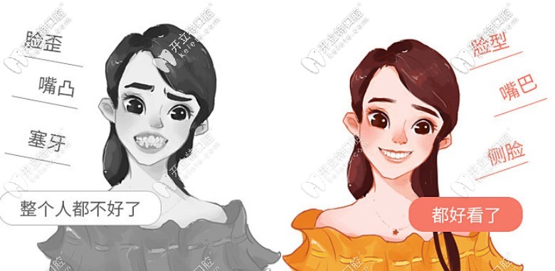 正畸“新玩法”，三場免費(fèi)試戴隱形牙套的機(jī)會(huì)來啦~