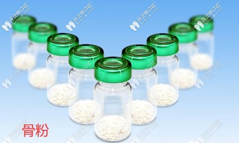 覺得種植牙填進(jìn)口Bioss骨粉價格貴的人建議看看與國產(chǎn)的區(qū)別