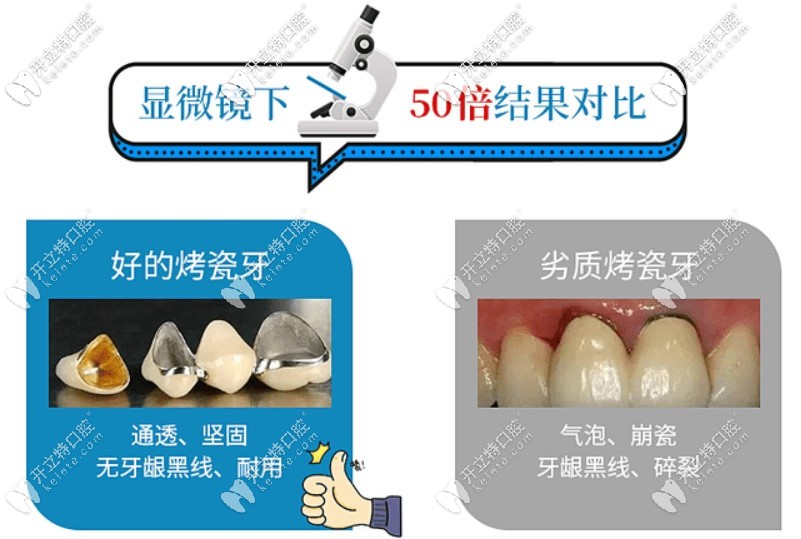 牙縫變大可以補(bǔ)嗎