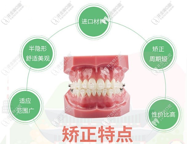 半隱形陶瓷自鎖托槽與普通托槽該怎么選