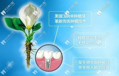 美國3I第三代納米種植牙的7大優(yōu)勢(shì)
