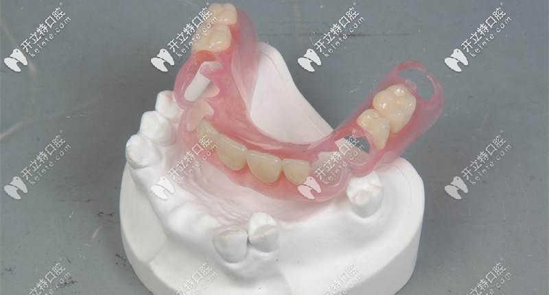 隱形活動(dòng)義齒又叫彈性義齒