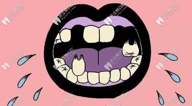 你沒看錯(cuò)，我就是缺牙了！