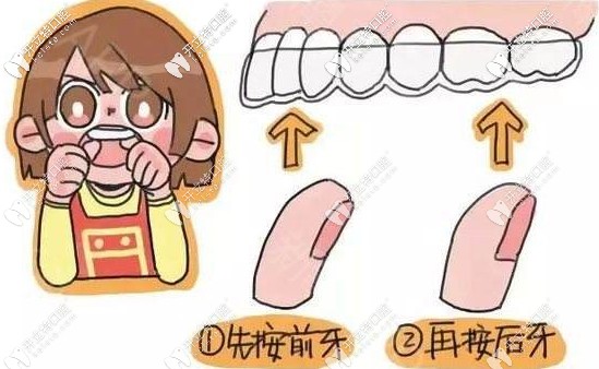 保持器的安裝步驟