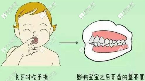 不良習(xí)慣會導(dǎo)致矯正反彈