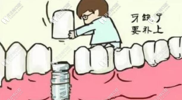 拔牙后多久適合做種植牙修復(fù)?聽聽專業(yè)種植醫(yī)生怎么說...