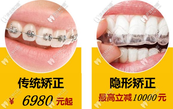 不得不說溫州牙齒矯正6千多元的價(jià)格還是比較劃算滴