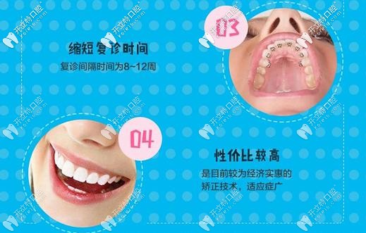 金屬矯正的優(yōu)勢