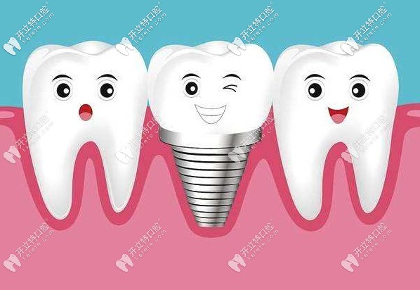 韓國(guó)登騰種植牙，種一顆送一顆