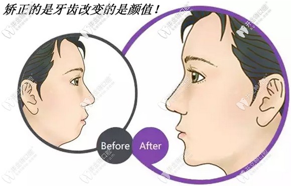 數(shù)字化矯正還兼顧了顏面美學設(shè)計