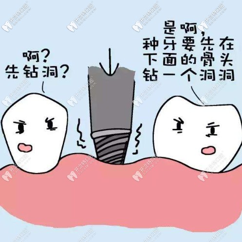 在牙槽骨的地方鉆洞植牙