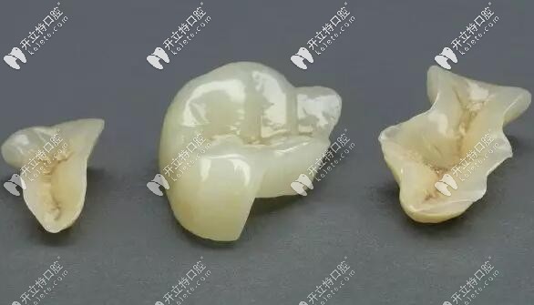 嵌體補(bǔ)牙材料