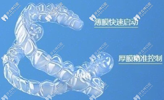 隱形牙套的放大照