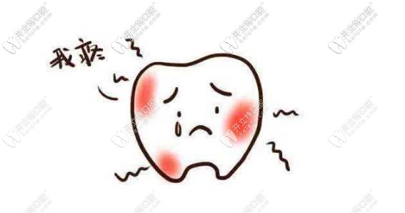 急性牙疼的小妙招