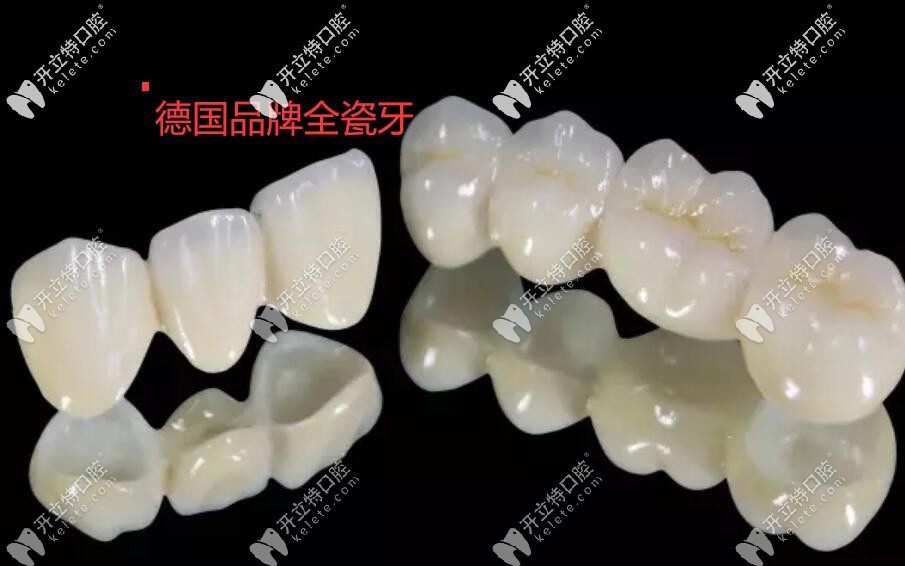 價(jià)格相差好幾百,威蘭德和阿曼吉爾巴赫全瓷牙到底有啥區(qū)別