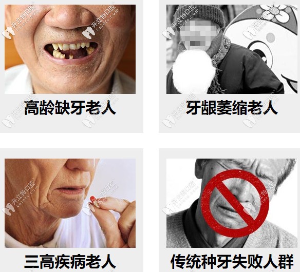 高齡缺牙、牙槽骨萎縮等都可以做種植牙