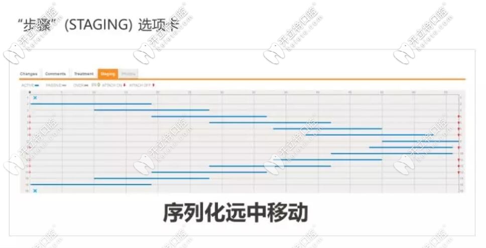 隱適美矯治器推磨牙步驟