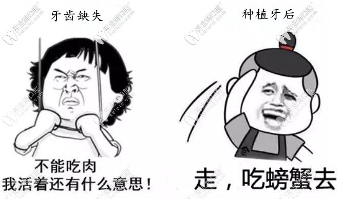 種植牙要使用一輩子,必須避開這4個坑選擇適合的種植體！