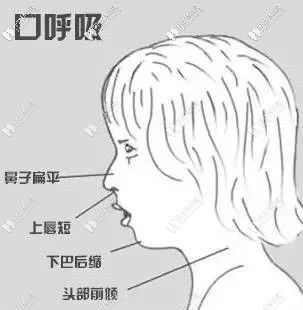 兒童的不良習(xí)慣會(huì)導(dǎo)致長(zhǎng)得不好看 兒童的不良習(xí)慣會(huì)導(dǎo)致長(zhǎng)得不好看