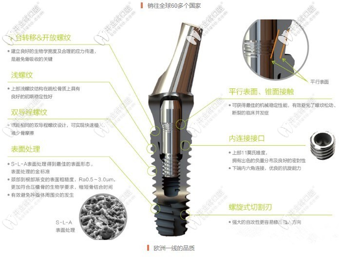 百康特種植體怎么樣