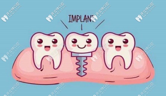 疫情防控期能做種植牙嗎?另附種植牙突發(fā)情況的應(yīng)對指南