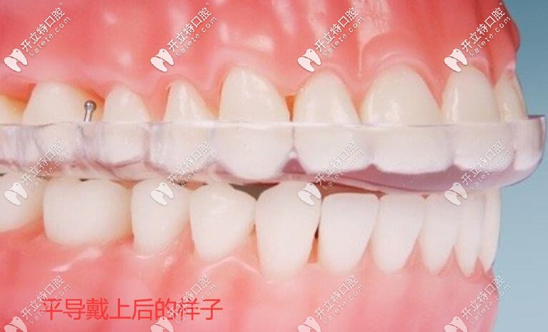 平導(dǎo)戴上后的樣子