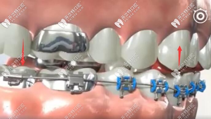 平導(dǎo)的作用原理