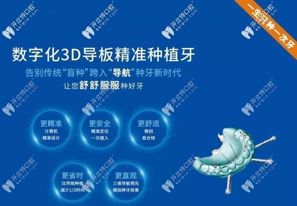 3D數(shù)字化導(dǎo)板種植牙技術(shù)精準(zhǔn)不翻瓣,費(fèi)用也劃算