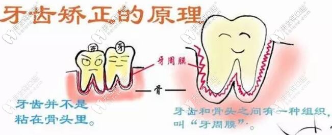 牙齒矯正的原理