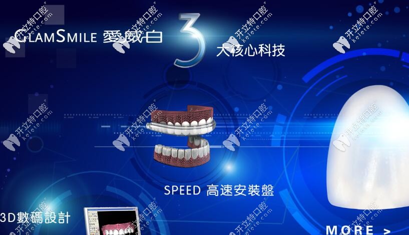 別問(wèn)多少錢(qián)了，先來(lái)科普下愛(ài)威白牙齒貼面的秘密