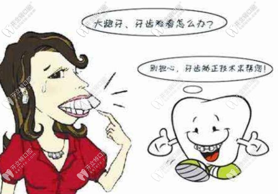 北京妹子說:因?yàn)楦F,選擇了價(jià)格居中的金屬自鎖托槽矯正