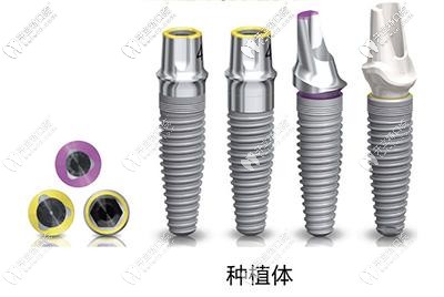 科普不同年齡的人做種牙時(shí),該怎么選擇種植體品牌？