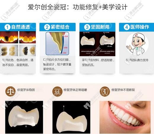 愛爾創(chuàng)瓷倍健全瓷牙優(yōu)勢
