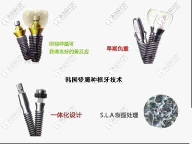 韓國登騰種植體