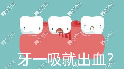 牙齒一吸就出血還有臭味,可能是牙齦炎在“作祟”哦