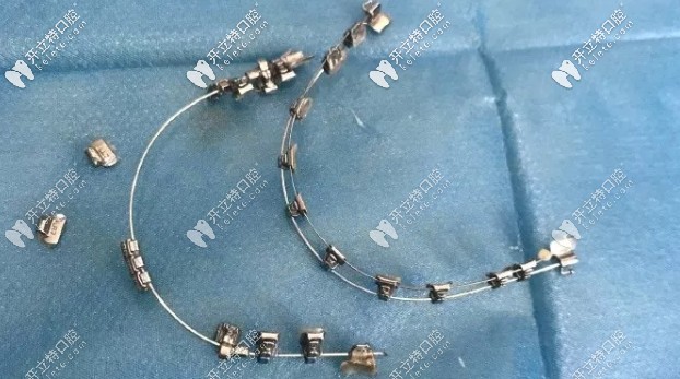 活動翼金屬托槽圖片