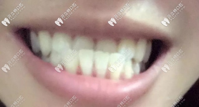 畸形的牙齒各有千秋，整齊的牙齒千篇一律