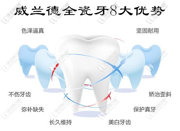 進(jìn)口威蘭德全瓷牙8大優(yōu)勢(shì)