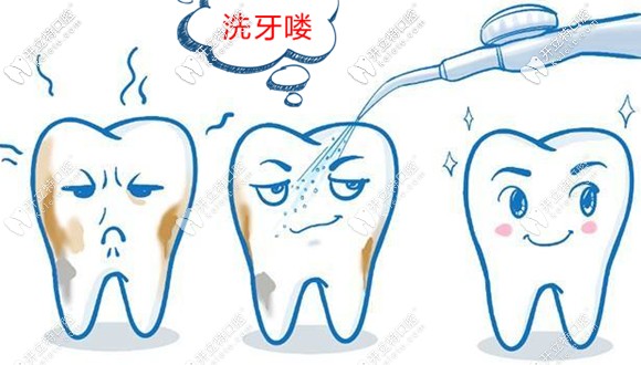 一般洗牙費(fèi)用在200元左右,為何深度洗牙的價(jià)格就要上千元?