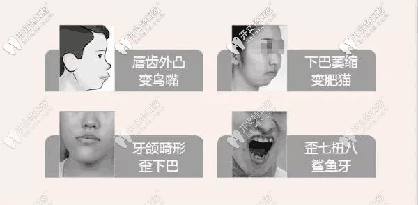 牙齒畸形幾種情況