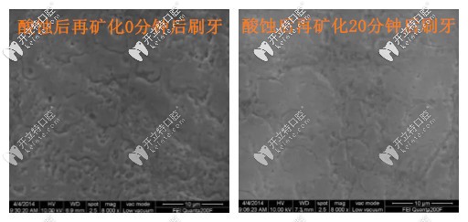 酸蝕在礦化的時(shí)間