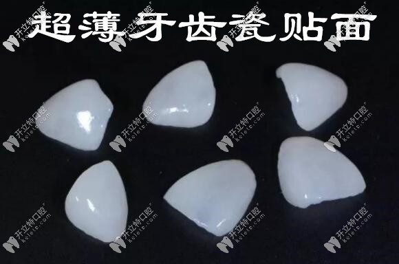 牙齒貼面會導(dǎo)致凸嘴嗎