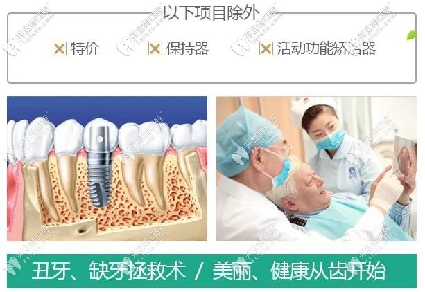 圣貝牙科種植牙和矯正活動