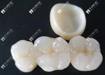 同是全瓷牙,為啥水晶鋯比二氧化鋯價(jià)格貴?原來(lái)區(qū)別在這里