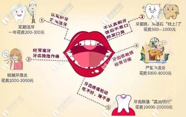 看牙的費(fèi)用好貴