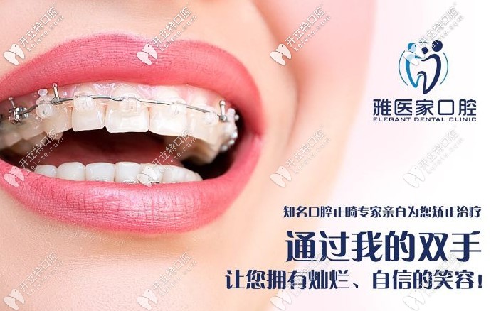 雅醫(yī)家口腔的特色項(xiàng)目